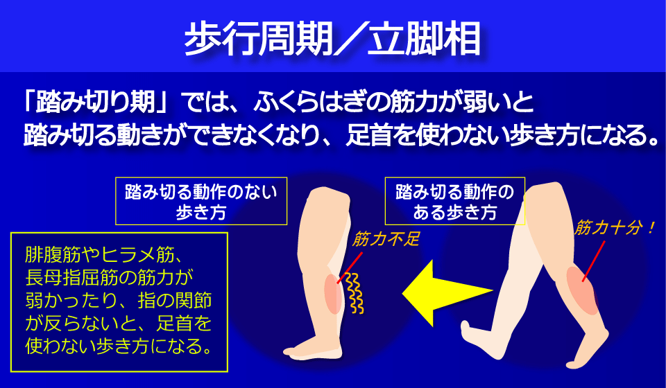 下腿後面の筋力が弱いと踏み切る動きができない／富士見台カイロプラクティックセンター