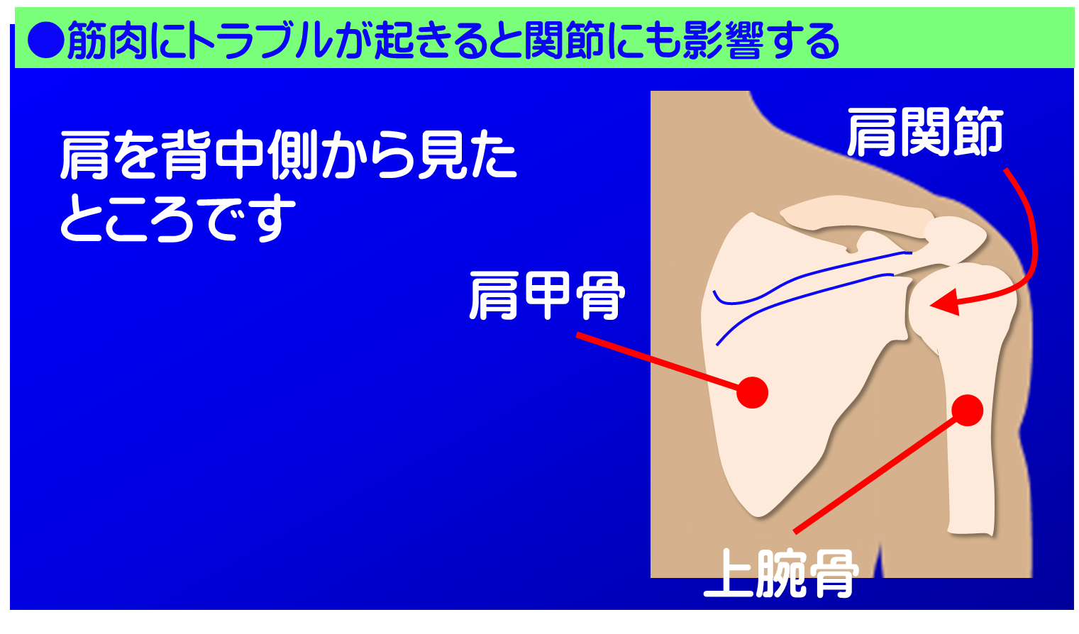 筋肉が原因の肩の痛み/富士見台カイロプラクティックセンター