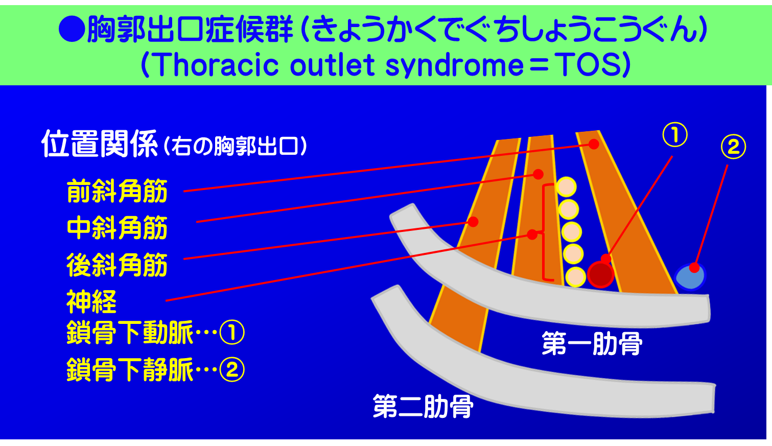 胸郭出口症候群／胸郭出口の神経・血管・筋肉の位置関係