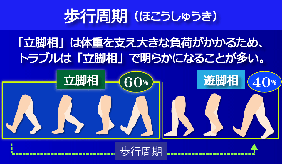 歩行周期　多くの問題が「立脚相」で明らかに／富士見台カイロプラクティックセンター